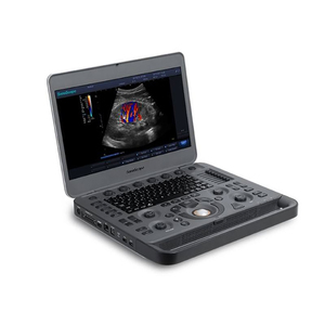 Échographe Doppler Couleur Portable Sonoscape X3 15,6'' Autonomie 90 min 3 sondes Abdomen Obstétrique Gynécologie Cardiologie CE - Product Image 3