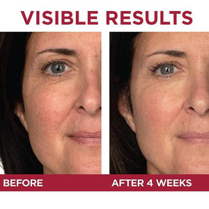 Crema Vegana Orgánica Antiedad para Ojos con Ácido Hialurónico, Vitamina C y Ácido Tranexámico para la Elasticidad de la Piel y Antiarrugas - Product Image 5