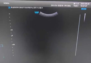 Sonda convexa, transductor de ultrasonido para reparación y sonda de ultrasonido, sonda de matriz curva, para uso en el exterior, por el momento - Product Image 5