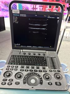CE ISO disetujui sonobape <span class=keywords><strong>S8exp</strong></span> warna Doppler portabel mesin Ultrasound plastik elektrik dengan layar LED 15 inci untuk rumah sakit - Product Image 3