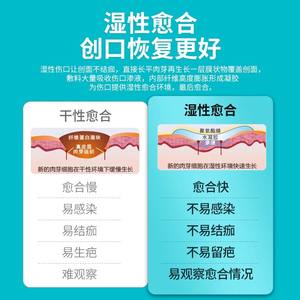 แผ่นปิดแผลอะลจิเนตแบบใช้แล้วทิ้งปลอดเชื้อสำหรับขายส่ง แผ่นปิดแผลเจลชุ่มชื้นแบบติดเอง สำหรับแผลกดทับ ใช้ทางการแพทย์ - Product Image 5