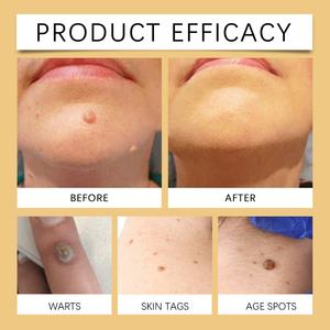 LANCER KING Crema y Loción Facial Orgánica con Ácido Hialurónico y Veneno de Abeja, Antiarrugas, Blanqueadora, Hidratante, para una Piel Radiante - Product Image 4