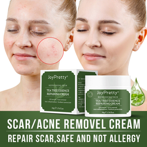 Etiqueta privada Cuidado de la piel facial Aceite de árbol de té orgánico natural Acné Espinillas Removedor de manchas oscuras Crema facial reparadora - Product Image 2