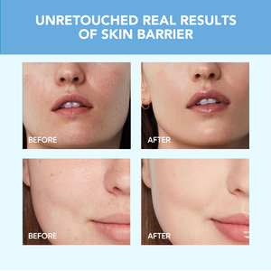 Crema hidratante 2024 para la cara, Etiqueta Privada, repare durante mucho <span class=keywords><strong>tiempo</strong></span> las manchas de su cara - Product Image 4