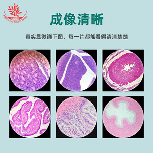 Muestras microscópicas del sistema endocrino: ovario, páncreas, fígado tímico, glándula pituitaria, secciones de muestras para aprendizaje médico básico - Product Image 4