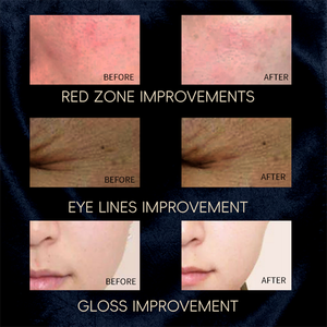 850nm gần hồng ngoại liệu pháp ánh sáng mặt nạ da chống lão hóa làm trắng sử dụng nhà LED mặt nạ vẻ đẹp thiết bị - Product Image 5