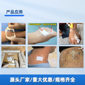 Medical Indwelling Needle Dressing 6x7cm Waterproof Transparent Sterile Class II For Infusion Catheter Fixation - Product Image 3