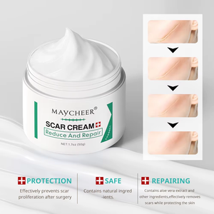 Lotion corporelle en gros pour estomper les cicatrices post-opératoires, les <span class=keywords><strong>vergetures</strong></span> <span class=keywords><strong>et</strong></span> réduire les <span class=keywords><strong>anciennes</strong></span> cicatrices, pour une peau lisse, à l'<span class=keywords><strong>Aloe</strong></span> <span class=keywords><strong>Vera</strong></span> - Revitalisant cutané - Product Image 2