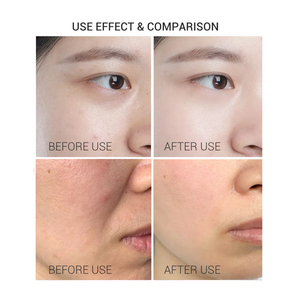 3 in 1 Essence Set Anti <strong>Aging</strong> Acne Treatment <strong>Vitamin</strong> a Hyaluronic Acid <strong>Vitamin</strong> C Skin Care Face Serum - Product Image 3