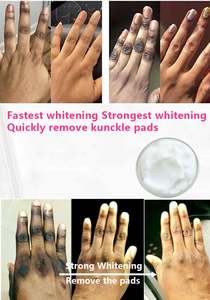 Sérum éclaircissant rapide pour les articulations foncées, correcteurs de pigmentation pour la <span class=keywords><strong>peau</strong></span> noire, mains, genoux, coudes, crème éliminatrice de taches intenses - Product Image 2