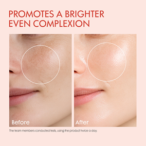 เซรั่มวิตามินซีบำรุงผิวหน้า MLM Private Label ขนาด 30 มล. ผสมโรสสควาเลน ช่วยให้ผิวกระจ่างใส ลดเลือนริ้วรอย ผลิตภัณฑ์ดูแลผิวหน้า รับผลิตแบบ OEM ODM - Product Image 6