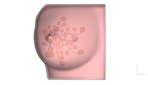 超音波乳房腫瘍穿刺モデル超音波ガイド乳房腫瘍穿刺トレーニングモデル一部の機能はカスタマイズ可能 - Product Image 4