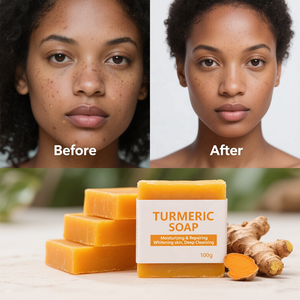 Jabón de limón de cúrcuma hecho a mano de etiqueta privada con jabón corporal hidratante blanqueador de Ácido Kójico - Product Image 2