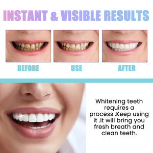 Nouvelle arrivée OEM Logo Blanchiment dentaire <span class=keywords><strong>Argile</strong></span> bentonite Poudre de perle naturelle active Poudre de blanchiment des <span class=keywords><strong>dents</strong></span> - Product Image 4