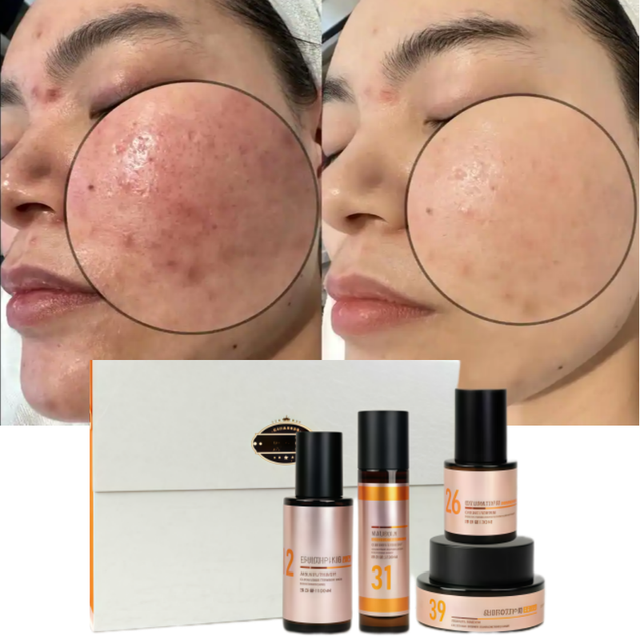 Best Dry Sensitive Skin Set Anti Redness of Face Ceramide Damaged Barrier Repair Moisturizing Skincare Kit for Combination Skin