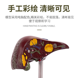 Modèle de pathologie hépatique, modèle de foie gras, modèle hépatobiliaire, foie malade, modèle d'anatomie hépatique humaine simulée - Product Image 4