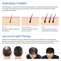 Capacete de tratamento de terapia de luz vermelha para crescimento do cabelo, venda quente, 2022