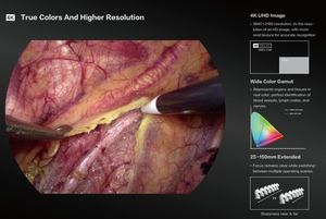 Mindray Vetina CS7獣医ポータブル内視鏡胃鏡カメラシステム柔軟なコロネスコープ内視鏡 - Product Image 6