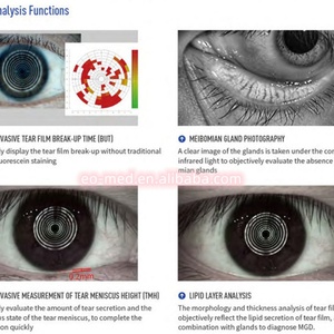 Instrumento de Examen Ocular Completo de Alta Precisión con Infrarrojos Rojos para Ojos Secos, Equipo Oftálmico, Analizador de Superficie Ocular DEA60 - Product Image 4