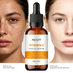 MUXYH Suero Hidratante con Vitamina C 30ml, Tratamiento Facial a <span class=keywords><strong>Base</strong></span> de Plantas, Esencia Natural para Aclarar la Piel - Product Image 2
