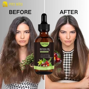 Các Nhà Sản Xuất Bán Buôn Tinh Khiết Tự Nhiên Chống-Rụng Tóc Tái Sản Xuất 3 Trong <span class=keywords><strong>1</strong></span> Batana Dầu Thương Hiệu Riêng Hữu Cơ Batana Dầu Cho Sự Tăng Trưởng Tóc - Product Image 1