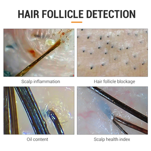 Hoge Kwaliteit Lage Prijs Hd Haarzakjes Hoofdhuid Scanner Detector Haaranalysator/Hoofdhuid Haaranalyse Machine - Product Image 3