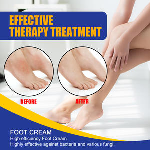 Crema de pedicura que nutre el cuidado de los pies, elimina el olor a beriberi, picazón en los pies, crema hidratante agrietada para reparar los pies secos - Product Image 5