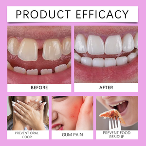 Adhesivo Termoplástico Oralhoe <span class=keywords><strong>para</strong></span> Dentaduras Postizas, Crema Adhesiva de Fijación Fuerte <span class=keywords><strong>para</strong></span> Reparación de Dentaduras, Venta al por Mayor OEM a Granel - Product Image 3