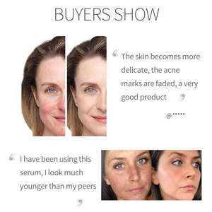 Sérum Visage Professionnel OEM Végétalien au Niacinamide Anti-Âge, à l'Arbutine et à l'Acide Hyaluronique – <span class=keywords><strong>Soin</strong></span> Équilibrant Avancé au Niacinamide - Product Image 3