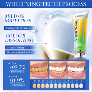 La Nueva Pasta de Dientes SADOER con Sabor a Limón y Menta, Blanquea, Elimina Manchas y Refresca el Aliento para Limpiar los Dientes - Product Image 5