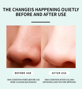 ओम ओम प्रकाश निजी लेबल प्राकृतिक गहरी सफाई काले सिर नाक के पैच ब्लैकहेड मास्क को हटाने के लिए मास्क चारकोल - Product Image 5