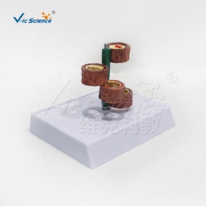 Modelo Vascular de Cuatro Secciones <span class=keywords><strong>para</strong></span> Ciencias Médicas, Modelo Educativo de Anatomía Vascular Humana - Product Image 2