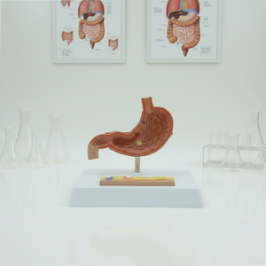 Modèle pathologique d'estomac en 2 parties - Démonstration de la transition de la gastrite à la perforation pour l'enseignement en gastroentérologie - Product Image 4