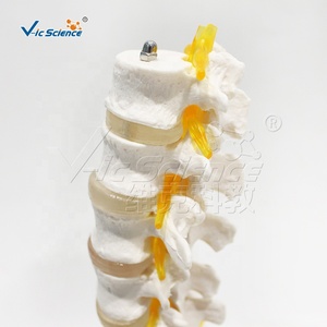Modèle d'enseignement d'<span class=keywords><strong>anatomie</strong></span> orthopédique de la colonne vertébrale humaine (lombaire, sacrum, coccyx) avec disque intervertébral et racine nerveuse - Product Image 3