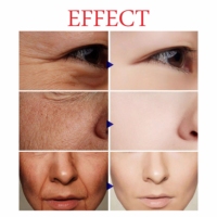 Sérum éclaircissant avancé 7 jours Best Cosmetics avec Glutathio Sepi White pour une peau plus éclatante, sérum éclaircissant et blanchissant pour le soin de la peau