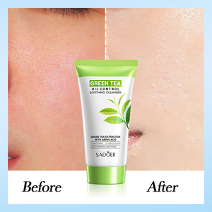 Nettoyant Visage Anti-Acné au Thé Vert Naturel et Bio – Contrôle du Sébum et Anti-Imperfections pour Tous Types de Peaux - Product Image 2