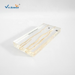 Espécimen de Resina, Espécimen Anatómico de Ascaris Lumbricoides, Espécimen Bioincrustado - Product Image 4