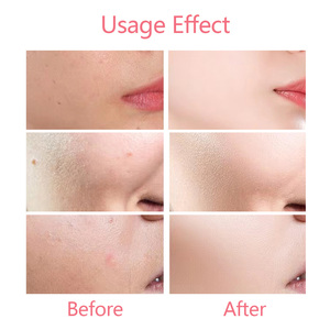 Set Siero Schiarente OEM con 10% Niacinamide Illumina la Pelle Spenta Riduce le Macchie Scure e Migliora il Tono Irregolare per una Carnagione Più Liscia - Product Image 4