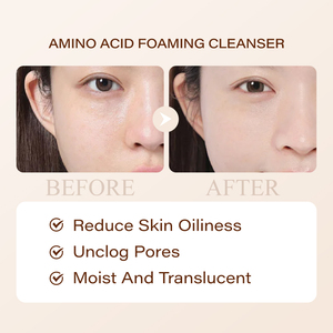 Sữa rửa mặt tạo bọt Niacinamide làm trắng da, trị mụn, chăm sóc da, làm đẹp, kiểm soát dầu, sữa rửa mặt tạo bọt, sữa rửa mặt amino acid - Product Image 4