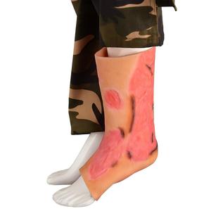 Modelo Realista de Piel con Simulación de Quemaduras <span class=keywords><strong>en</strong></span> Brazo, Mano <span class=keywords><strong>y</strong></span> Pierna para Entrenamiento de Primeros Auxilios - Product Image 2