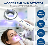 Taşınabilir Tıbbi Wood Lambası, Cilt Lekelerinin Analizi için Vitiligo Görüntüleri Yakalamak İçin Kullanılır.