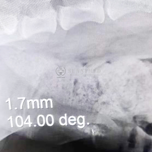 SY-WPS01 Veterinary Holmium <strong>Laser</strong> Lithotripter <strong>Surgical</strong> Use Minimally Invasive Lithotripsy Stone Fragmentation Machines - Product Image 6