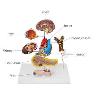 Modèle médical de diabète 8 pièces globe oculaire coeur rein vaisseau sanguin pied modèle d'anatomie détachable affichage du diabète aide à la pathologie - Product Image 3