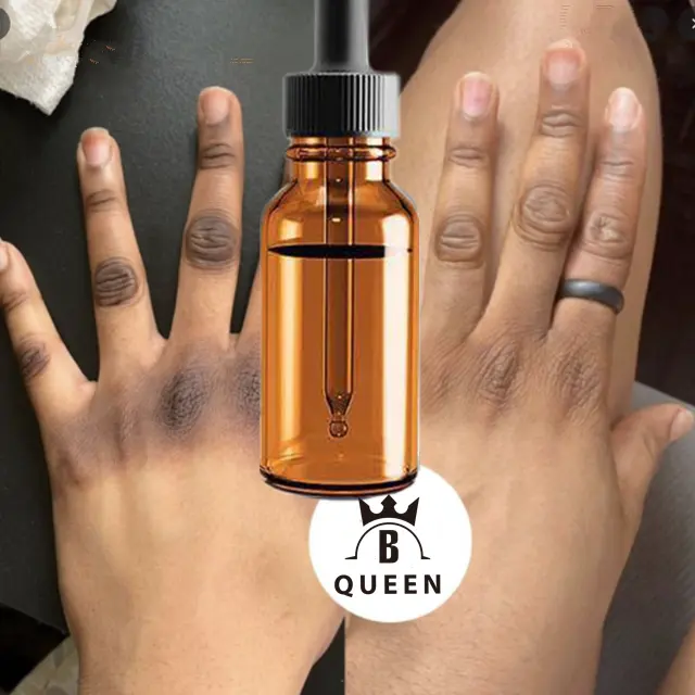 Groothandel Dark Knuckle Verwijderen Olie Voor Skin Whitening Met Uw Eigen Merk