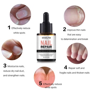 Etiqueta privada Nail Foot Protector Nail Fungus Tratamiento Reparación de uñas para infecciones fúngicas dañadas - Product Image 4