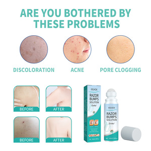 Bâtons de morsure avec logo personnalisé, solution pour dresser les gros chiens contre les coups de rasoir - Product Image 6