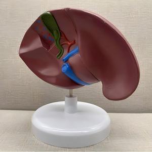 Modèle du Foie et de la Vésicule Biliaire Pathologique - Outil Pédagogique en Hépatologie - Product Image 2