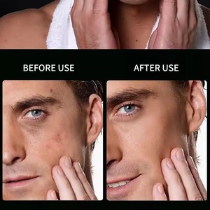 Ensemble de soins de la peau de qualité supérieure pour hommes Marque privée Lotion tonique hydratante réparatrice Ensemble de soins du visage non gras - Product Image 5