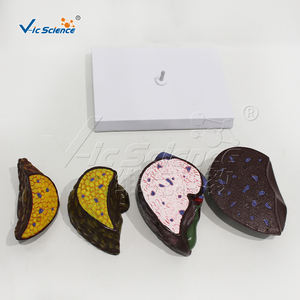 Modelo hepático doente (quatro estágios) hepatite crônica - Product Image 2