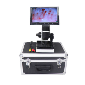 Capillaroscope vidéo biologique SY-B198 Microscope de pli d'ongle de 10 pouces <span class=keywords><strong>Microcirculation</strong></span> reliée à l'ordinateur portable - Product Image 1